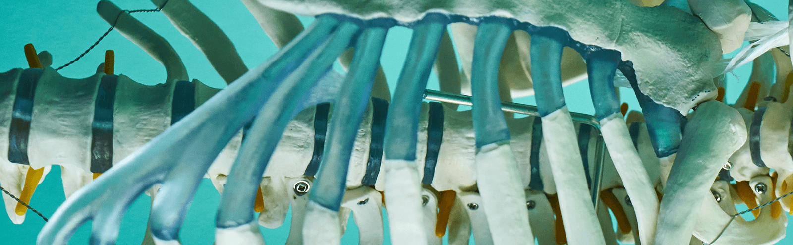 A medical model of a spine and ribcage set against a turquoise background